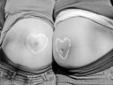 Baby tummys